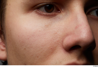  HD Skin Johny Jarvis cheek eye face head nose skin pores skin texture 0001.jpg